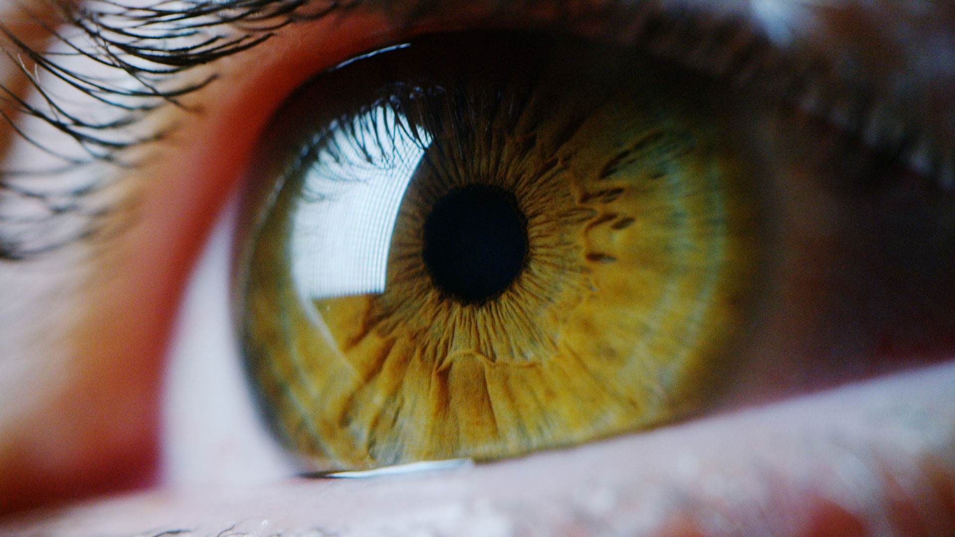 Slider with macroscopic image of a human eye.