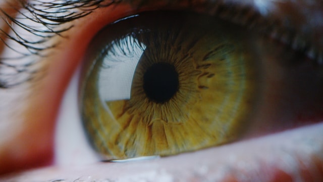  Imagem macroscópica de um olho humano.